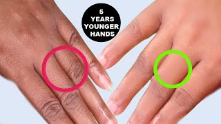 MAKE YOUR HANDS LOOK 5 YEARS YOUNGER REMOVE WRINKLES TREAT DRY HANDS ROUGH HANDS SMOOTH HYDRATED [upl. by Anegue654]