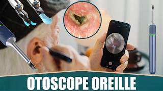 LE MEILLEUR OTOSCOPE CAMÉRA OREILLE  VLIKE [upl. by Deacon401]