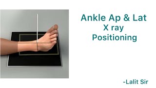 Ankle x ray positioning [upl. by Hesketh]