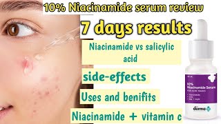 The Derma co niacinamide serum Review  niacinamide uses  Niacinamide10 zinc1 [upl. by Seymour991]