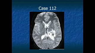 RADIOLOGY EXAM CASES [upl. by Casper]