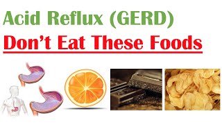 Worst Foods to Eat with Acid Reflux GERD Gastroesophageal Reflux Disease  How to Reduce Symptoms [upl. by Cantone]