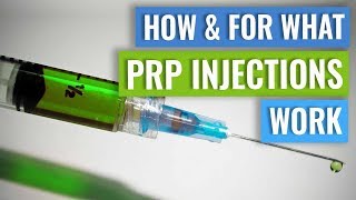 How do PRP injections work [upl. by Perrin]