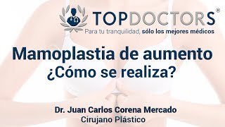 Mamoplastia de aumento ¿Cómo se realiza [upl. by Heintz]