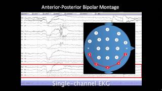 Introduction to EEG [upl. by Freddie755]