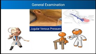 General Examination  Jugular Venous Pressure  JVP  Components of JVP  Cuases of Raised JVP [upl. by Eiuqnimod]