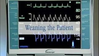 Datascope CS100 Tutorial [upl. by Ocinom]