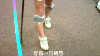 脊髓中風病患使用Walkaide Spinal Stroke using WalkAide [upl. by Onaled298]