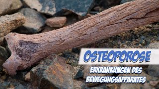 Osteoporose  Erkrankungen des Bewegungsapparats  Pflege Kanal [upl. by Oigolue440]