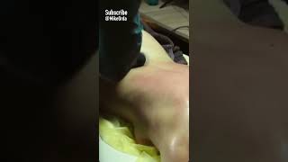 Back massage amp cupping therapy  МАССАЖ СПИНЫ  Russia [upl. by Redmer]