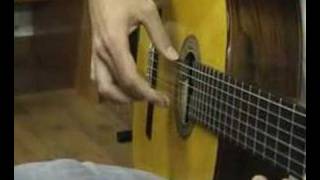 1Flamenco guitarist and focal hand dystonia Distonía focal [upl. by Armbruster]