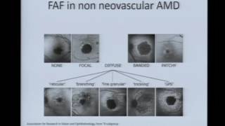 Fundus Autofluorescence [upl. by Einor107]