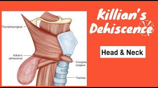 Killian Dehiscence  Pharyngeal diverticulum  Killian Dehiscence anatomy  Diagram  Head amp Neck [upl. by Gunas]