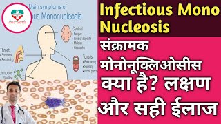 Infectious Mononucleosis MONO संक्रामक मोनो कि बीमारी क्या होती है ईलाज क्या है  पूरी जानकारी [upl. by Ahsinyar589]