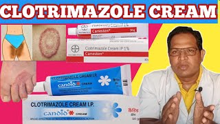 Clotrimazole cream  clotrimazole cream ip  Candid cream for itching Canesten cream [upl. by Ulyram]