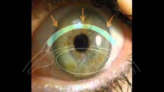 Cornea 1 A Remarkable Structure [upl. by Inavoy]