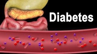 Diabetes Type 1 and Type 2 Animation [upl. by Brew]