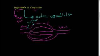 46Hyperemia vs Congestion [upl. by Aray]