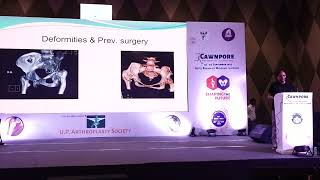 14 Cawnpore Arthroplasty Course 2023 Day 2 Part 21 [upl. by Grider]