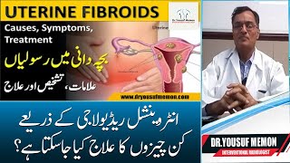 Uterine Fibroids  UFE Embolization  Interventional Radiology in Pakistan  Urdu DrYousuf Memon [upl. by Casar]