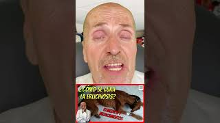 ERLICHIOISIS CANINA 🆘 QUE ES SÍNTOMAS FASES TERMINAL CRÓNICA DIAGNOSTICO Y TRATAMIENTO CASER [upl. by Agosto]