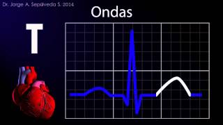 Electrocardiografía Básica Parte 14 [upl. by Ydnes]