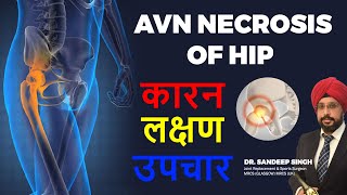 AVN Necrosis Of Hip जीवन को जीने का नई तरीका  AVN Hip  Dr Sandeep Singh [upl. by Hsac]