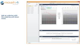 Noah Audiogram Module Features with audio [upl. by Joacimah]