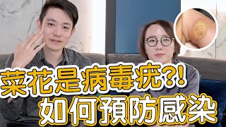 病毒疣會傳染怎麼辦？莊盈彥醫師跟蕭全佑醫師教大家如何治療及預防！ [upl. by Fanning837]