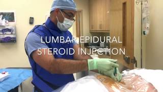 Epidural Steroid Injection Procedure by Eddy Feliz MD [upl. by Culbert]