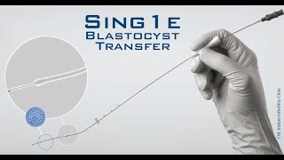 Embryo Transfer  Ultrasound Guided Embryo Transfer During ET  Embryo loading amp transferring [upl. by Enirehtak431]