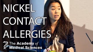 Causes of nickel skin allergies  Dr Teresa Tsakok [upl. by Marketa]