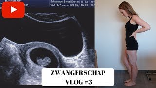 EERSTE ECHO amp MISSELIJK  6 7 amp 8 weken  ZWANGERSCHAP VLOG 3 [upl. by Anahpos182]