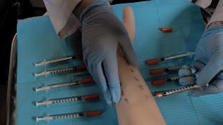 ASMR Hospital Allergy Testing  Intradermal Test Skin Exam [upl. by Annahsad]