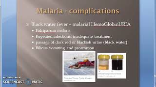 Parasitology 075 i Plasmodium Falciparum Malaria Complication Malignant black water fever algid [upl. by Annatsirhc]