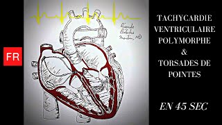 Arythmies animation cardiaque et ECG  Tachycardie Ventriculaire Polymorphe Shorts [upl. by Pryce]