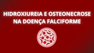 Hidroxiuréia e osteonecrose na Doença Falciforme [upl. by January]