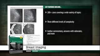 Breast Imaging 2nd Edition [upl. by Killion847]