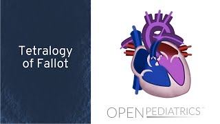 Tetralogy of Fallot by M Mazwi  OPENPediatrics [upl. by Tonie410]