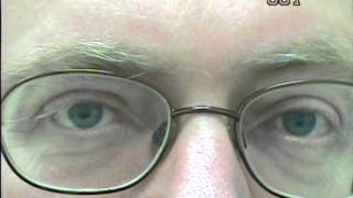 Nystagmus eye movement recording 1 [upl. by Killen]