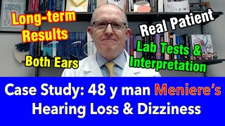 Case Study 48 y man Ménières disease Hearing Loss Dizziness long term treatment results [upl. by Elatsyrk]