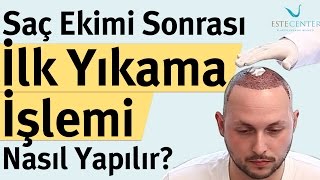 Saç Ekimi Sonrası İlk Yıkama İşlemi Nasıl Yapılır [upl. by Cummine]