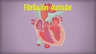 Cómo Vivir con Fibrilación Auricular [upl. by Joelie]