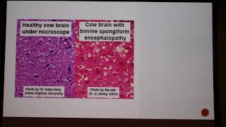 Bovine Spongiform Encephalopathy BSE 2018 [upl. by Anig]