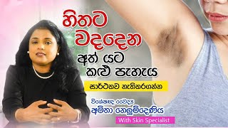 හිතට වදදෙන අතයට කළුවීමට ප්‍රතිකාර  Under Arm Darkness  Skin Specialist [upl. by Berstine]