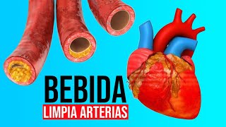 3 Ingredientes se viralizan al ser capaces de limpiar las arterias coronarias [upl. by Nivlen616]