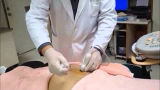 UltrasoundGuided Sacroiliac Joint Injection Technique [upl. by Rhyner]