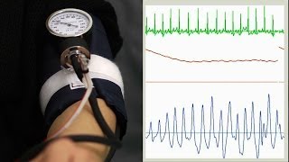 Oscillometric blood pressure measurement [upl. by Gilbert]