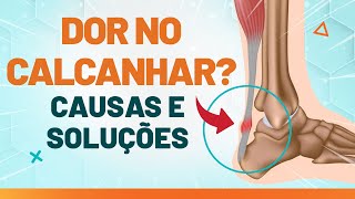 Fascite Plantar Dor no Calcanhar Como Tratar – Dr André Mansano Tratamento da Dor [upl. by Erialb]