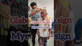 glabellar tap sign in Parkinsons Disease  Myersons sign  Glabellar Reflex mbbs neet [upl. by Bennett]